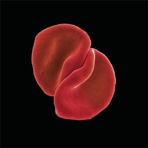 Álbum Scratch My Back de Peter Gabriel